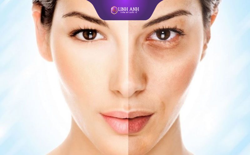dấu hiệu da mặt đang thải độc thải độc da là gì