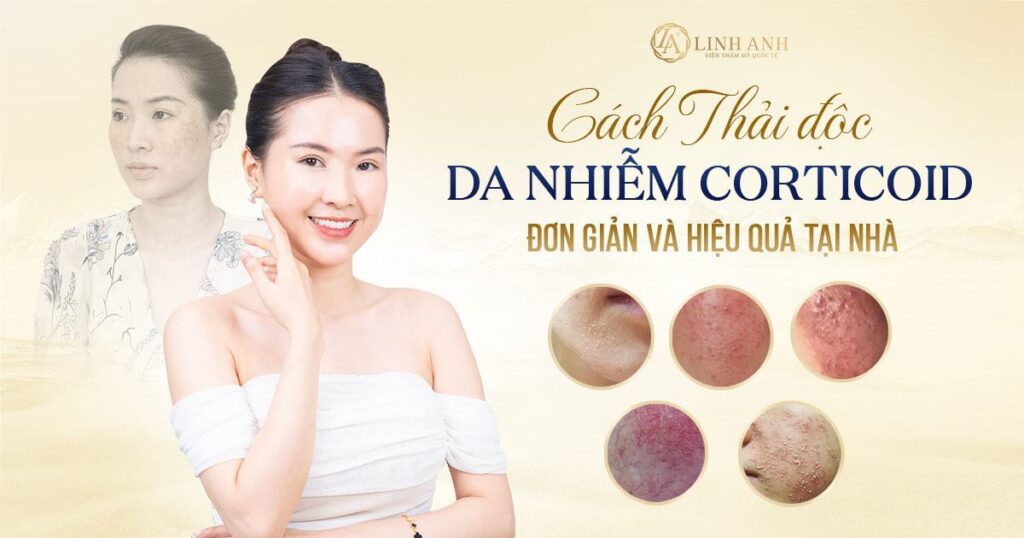 thải độc da nhiễm corticoid - Viện thẩm mỹ quốc tế Linh Anh