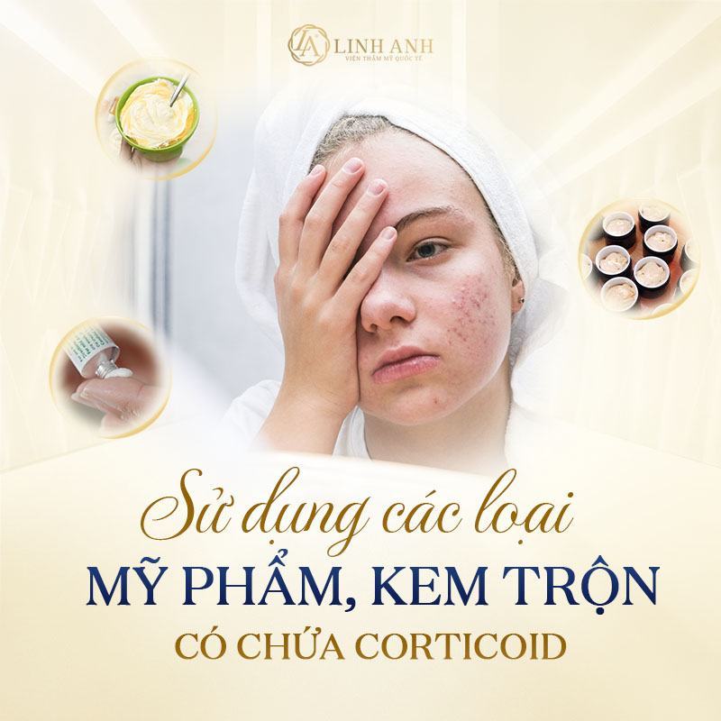thải độc da nhiễm corticoid tại nhà - Viện thẩm mỹ quốc tế Linh Anh thải độc da nhiễm corticoid tại nhà - Viện thẩm mỹ quốc tế Linh Anh