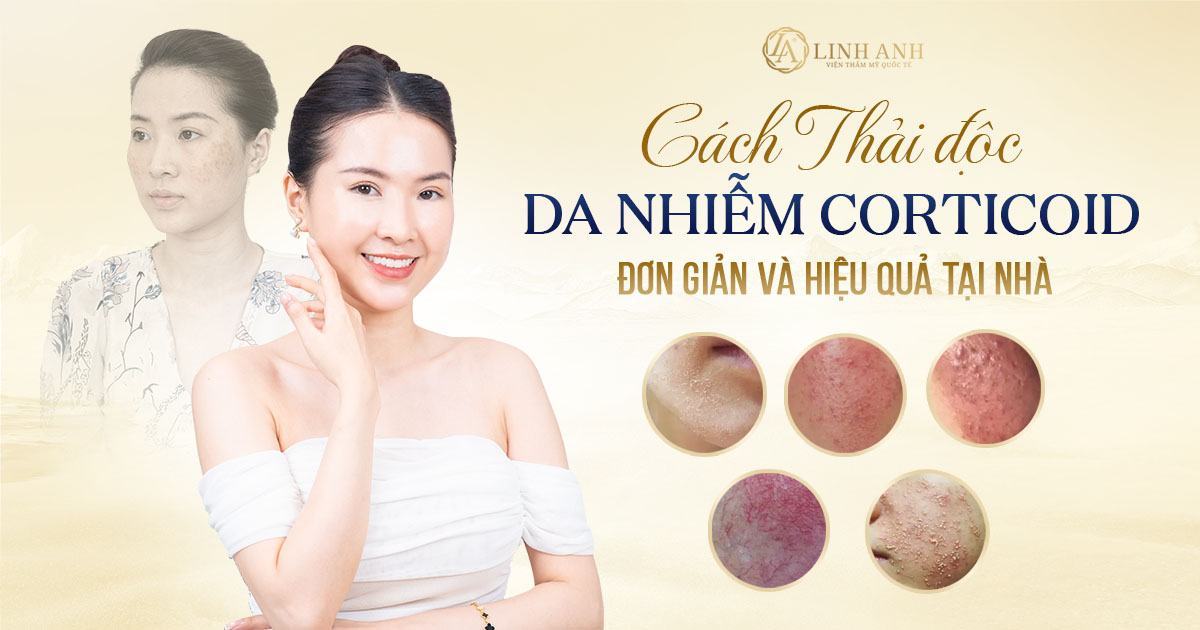 thải độc da nhiễm corticoid - Viện thẩm mỹ quốc tế Linh Anh