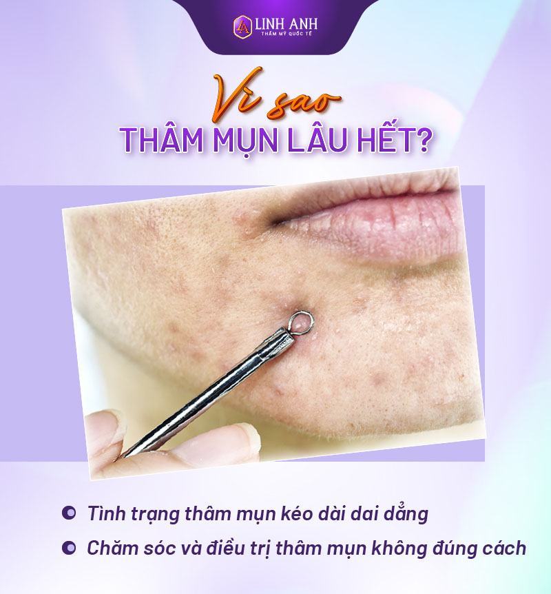 vết thâm mụn bao lâu thì hết thâm mụn sau bao lâu thì hết