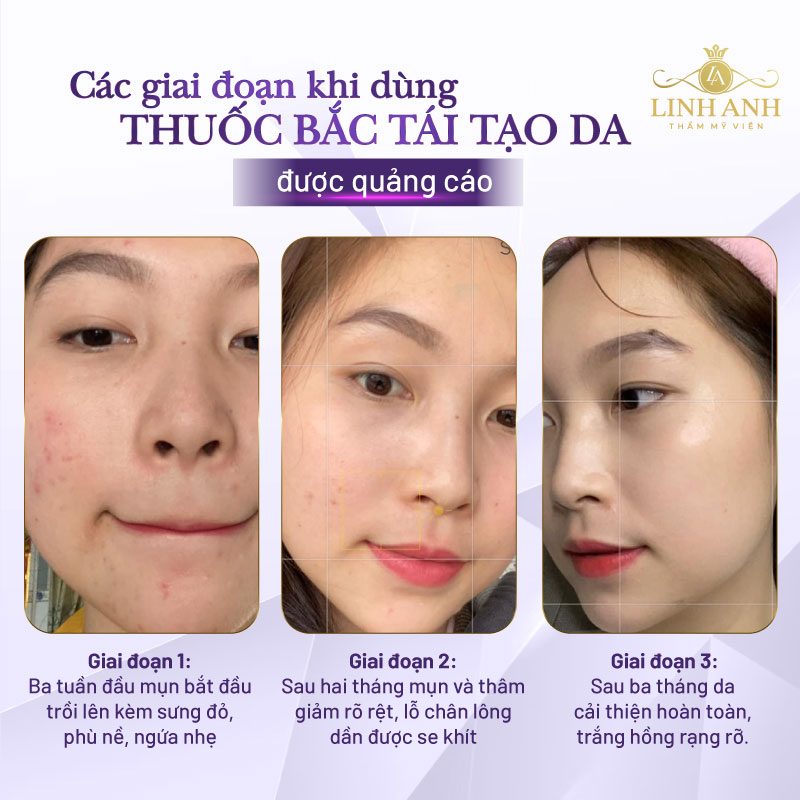 thuốc bắc gia truyền tái tạo da có tốt không