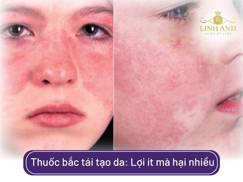 thuốc bắc tái tạo da có nguy hiểm không