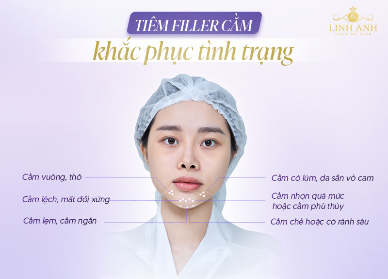 Tiêm filler độn cằm giá bao nhiêu