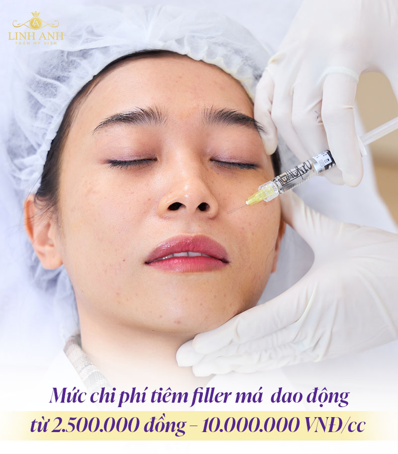 tiêm filler má giá bao nhiêu Tiêm má baby bao nhiêu