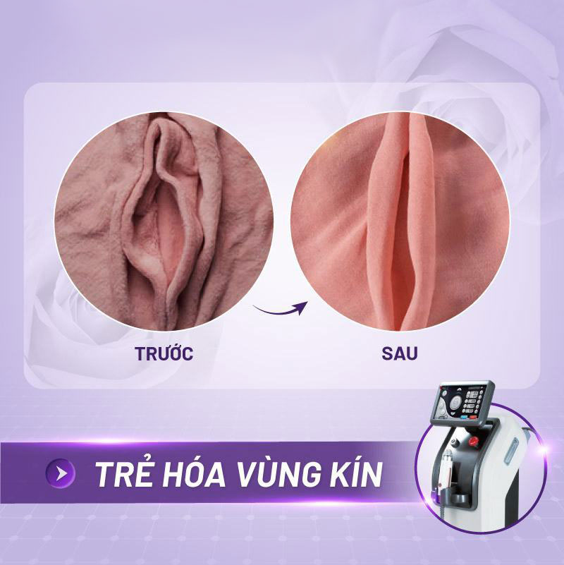 trẻ hoá cô bé giá bao nhiêu trẻ hoá cô bé giá bao nhiêu