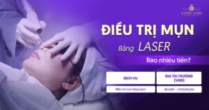 trị mụn bằng laser bao nhiêu tiền