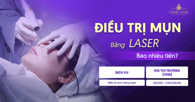 Trị mụn bằng laser bao nhiêu tiền? Bảng giá cập nhật mới nhất