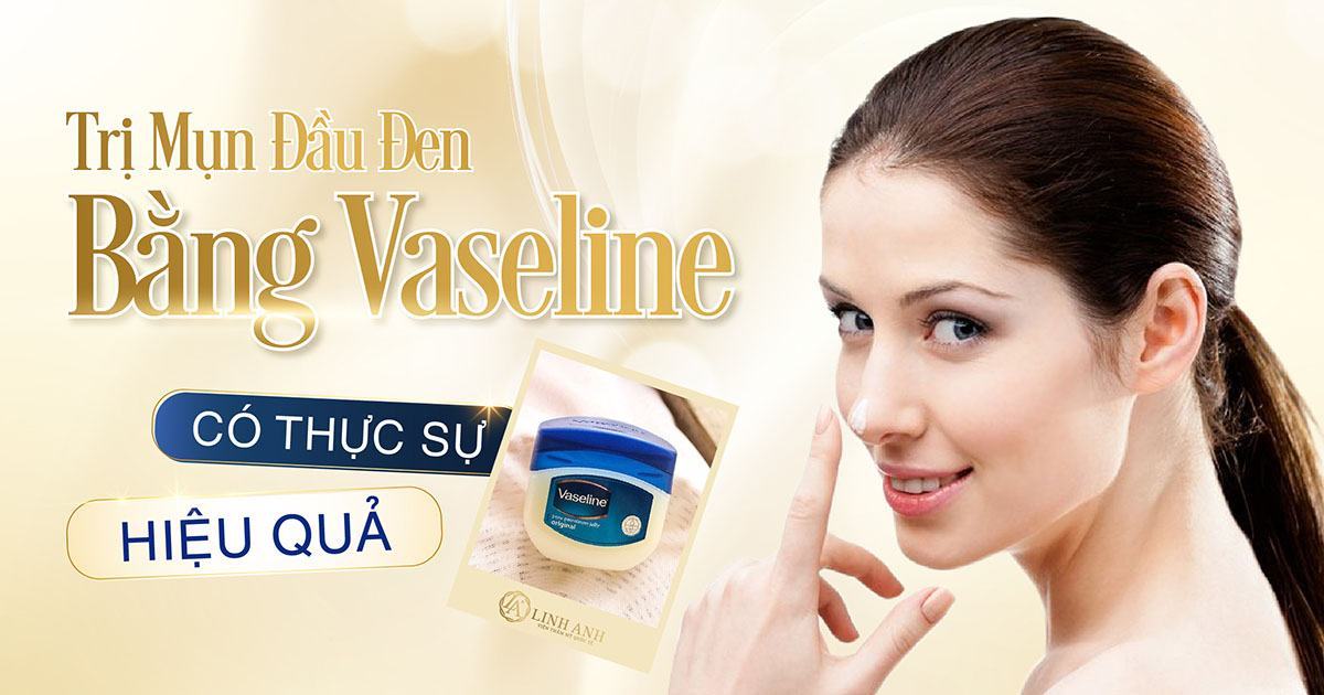trị mụn đầu đen bằng vaseline - Viện thẩm mỹ quốc tế Linh Anh