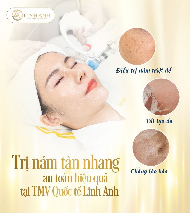 trị tàn nhang bằng rau mồng tơi trị nám bằng lá mồng tơi - Viện thẩm mỹ quốc tế Linh Anh