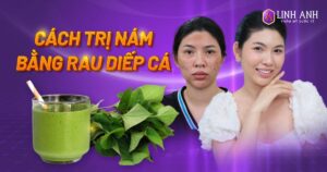 trị nám bằng rau diếp cá