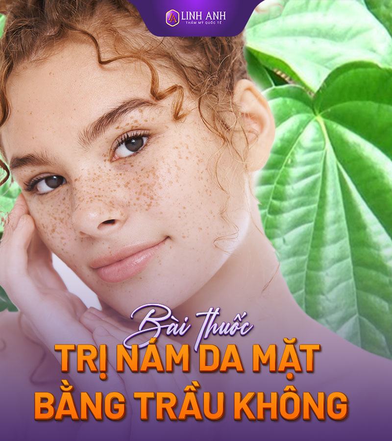 bài thuốc dân gian trị nám tàn nhang trị nám da mặt bằng phương pháp dân gian