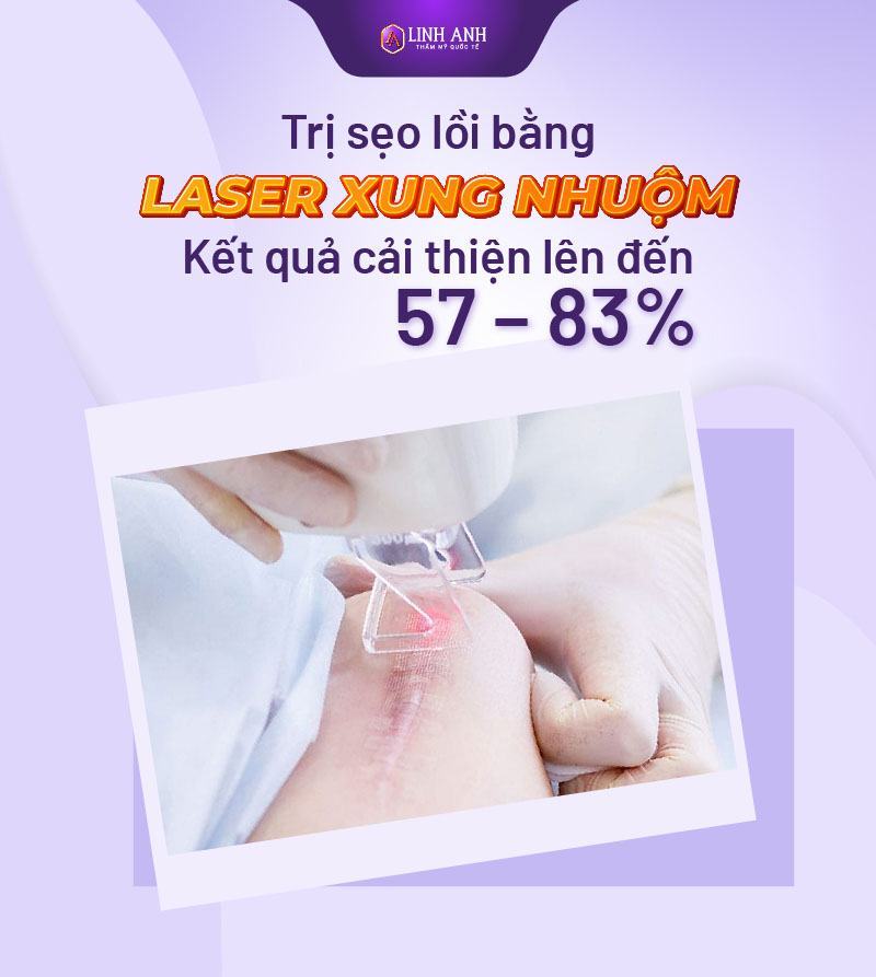 trị sẹo lồi tại nhà trị sẹo lồi tại nhà