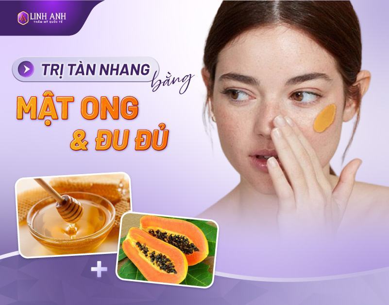 cách trị tàn nhang bằng mật ong và nha đam