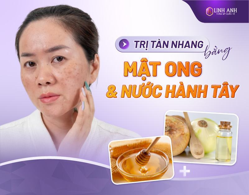 trị tàn nhang bằng mật ong