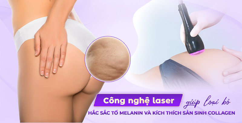 trị thâm mông giá bao nhiêu