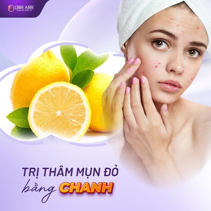 thâm đỏ sau mụn trị thâm đỏ sau mụn nhanh nhất