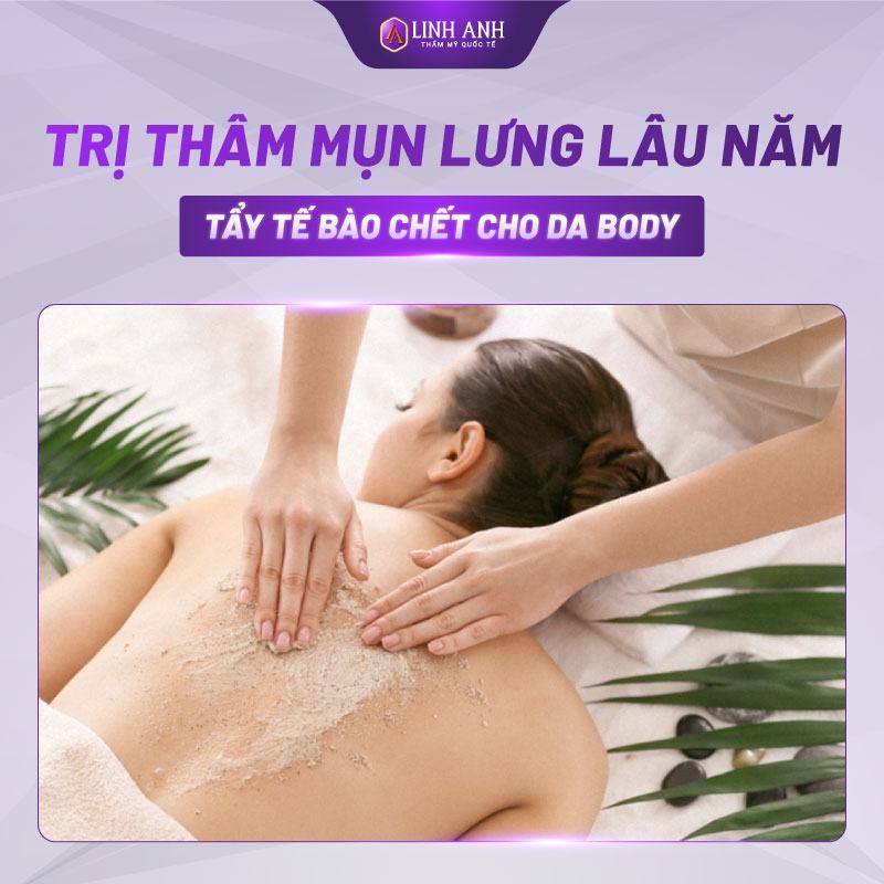 trị thâm mụn lưng spa trị thâm mụn ở lưng