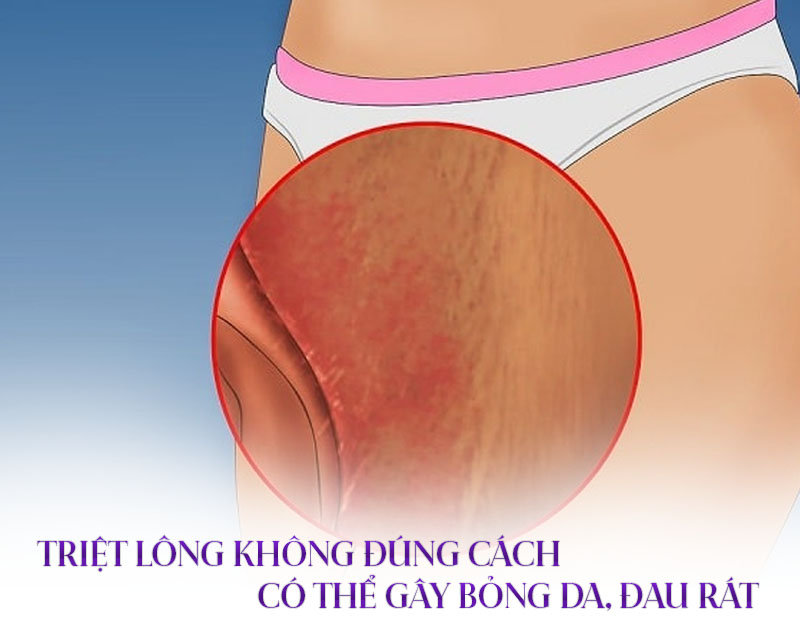 triệt lông vùng kín có ảnh hưởng gì không triệt lông vùng kín có ảnh hưởng gì không