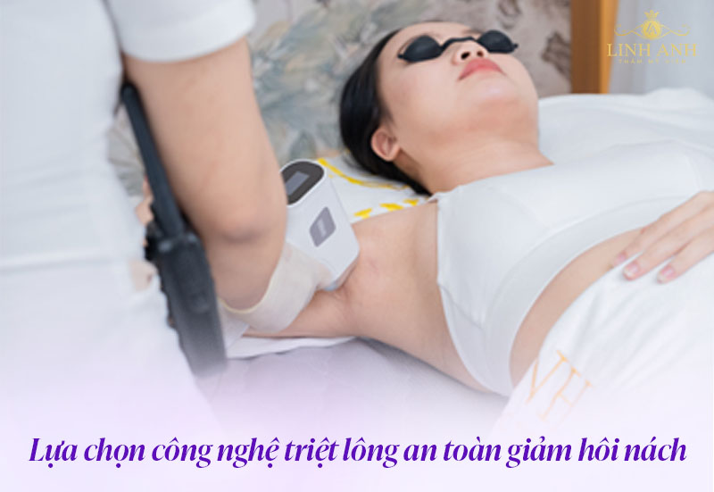 Triệt lông nách có hết hôi không