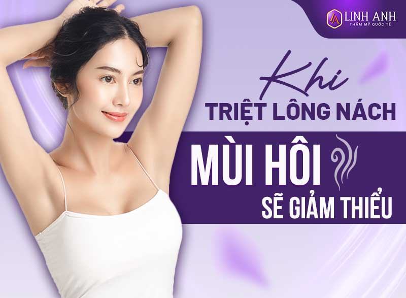 tại sao triệt lông nách lại bị hôi nách - Thẩm mỹ Quốc tế Linh Anh triệt lông nách có hết hôi nách không