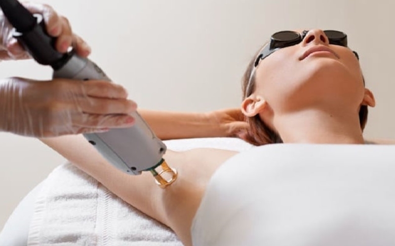 triệt lông nách lại bị hôi nách triệt lông nách lại bị hôi nách