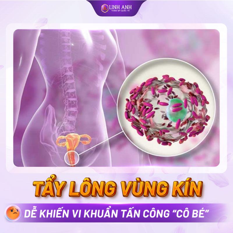 tác hại của triệt lông vùng kín triệt lông vùng kín nữ có ảnh hưởng gì không