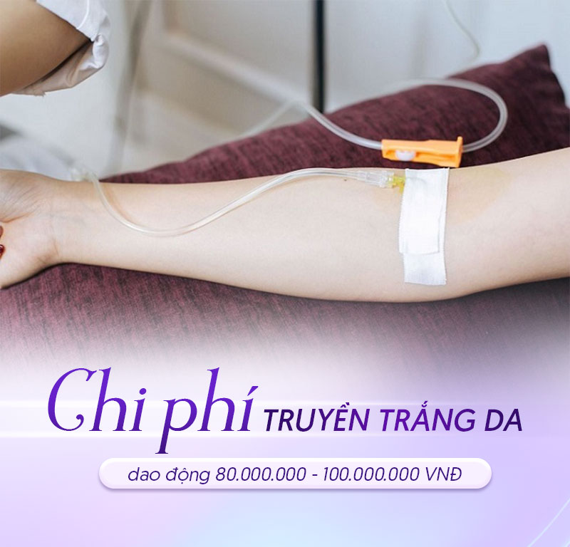 truyền trắng hết bao nhiêu tiền truyền trắng hết bao nhiêu tiền