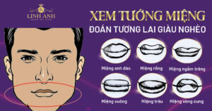 tướng miệng