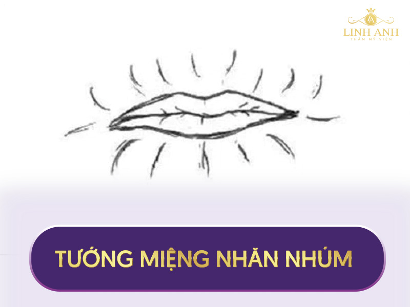 tướng miệng chuột