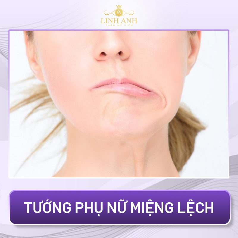 tướng miệng phụ nữ xấu