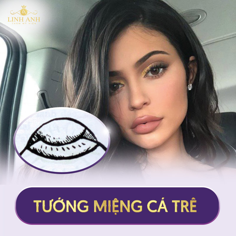 tướng miệng phụ nữ
