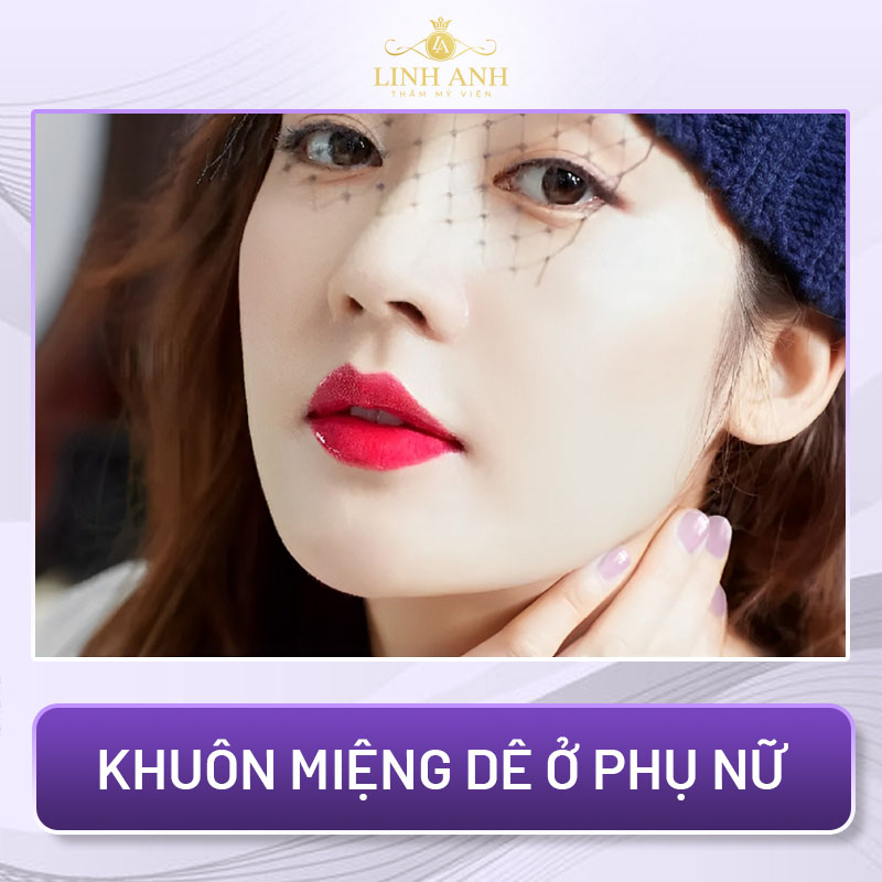 tướng miệng xấu của người phụ nữ