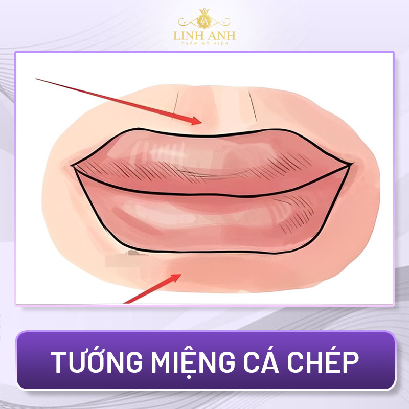 tướng miệng xấu