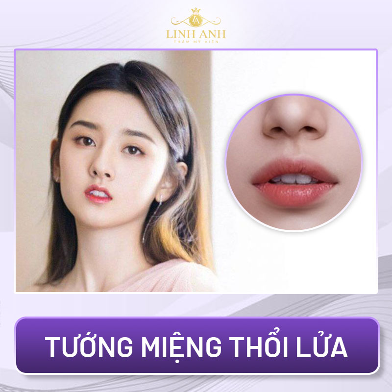 tướng môi khổ