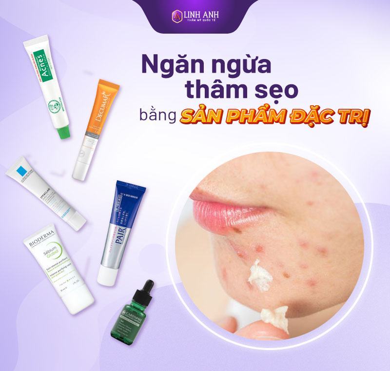 nặn mụn xong nên bôi gì - Thẩm mỹ Quốc tế Linh Anh vừa nặn mụn xong nên làm gì