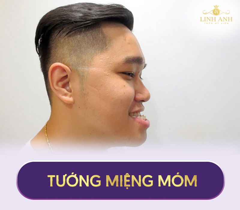 xem tướng miệng