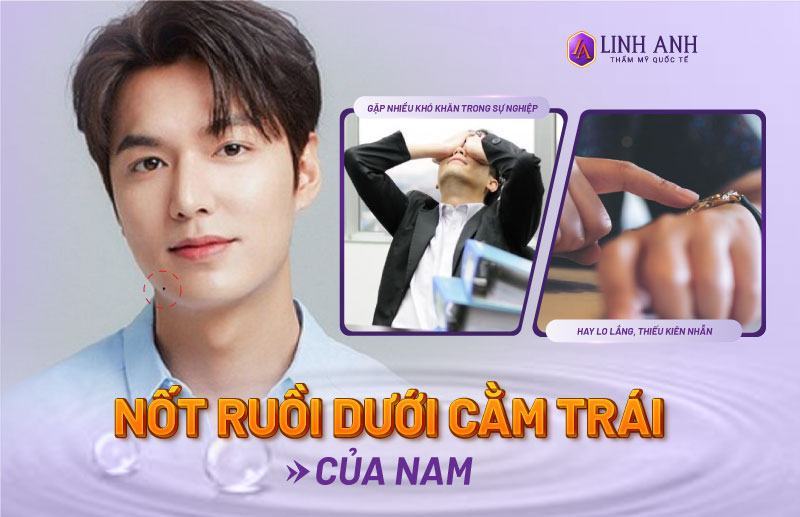 xem tướng nốt ruồi dưới cằm xem tướng nốt ruồi dưới cằm