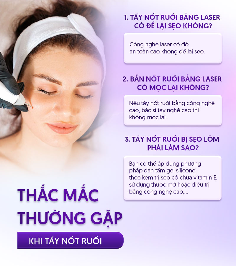 xóa nốt ruồi bằng laser giá bao nhiêu xóa nốt ruồi bằng laser giá bao nhiêu