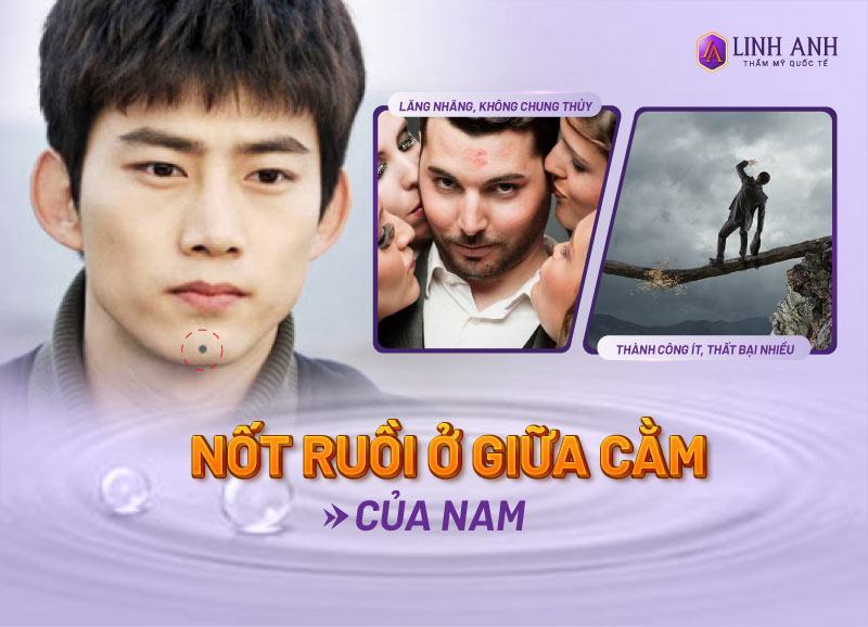 ý nghĩa nốt ruồi dưới cằm ý nghĩa nốt ruồi dưới cằm