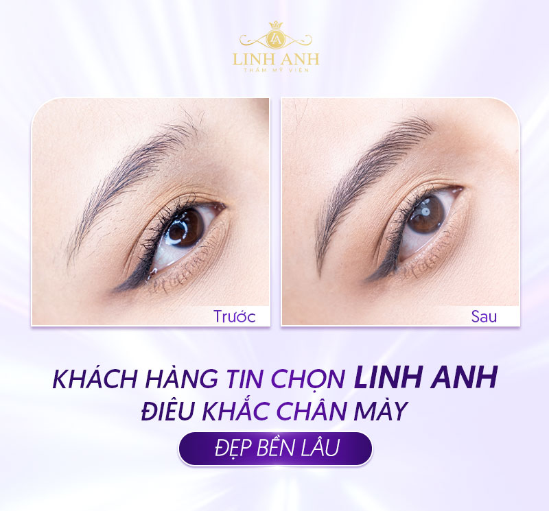 bảng giá điêu khắc mày tại TMV Linh Anh bảng giá điêu khắc mày tại TMV Linh Anh
