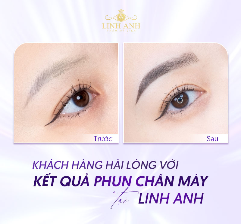 bảng giá phun mày tại TMV Linh Anh bảng giá phun mày tại TMV Linh Anh