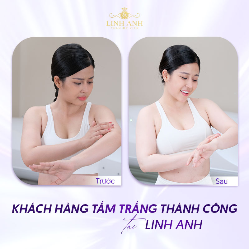 bảng giá tắm trắng tại TMV Linh Anh bảng giá tắm trắng tại TMV Linh Anh