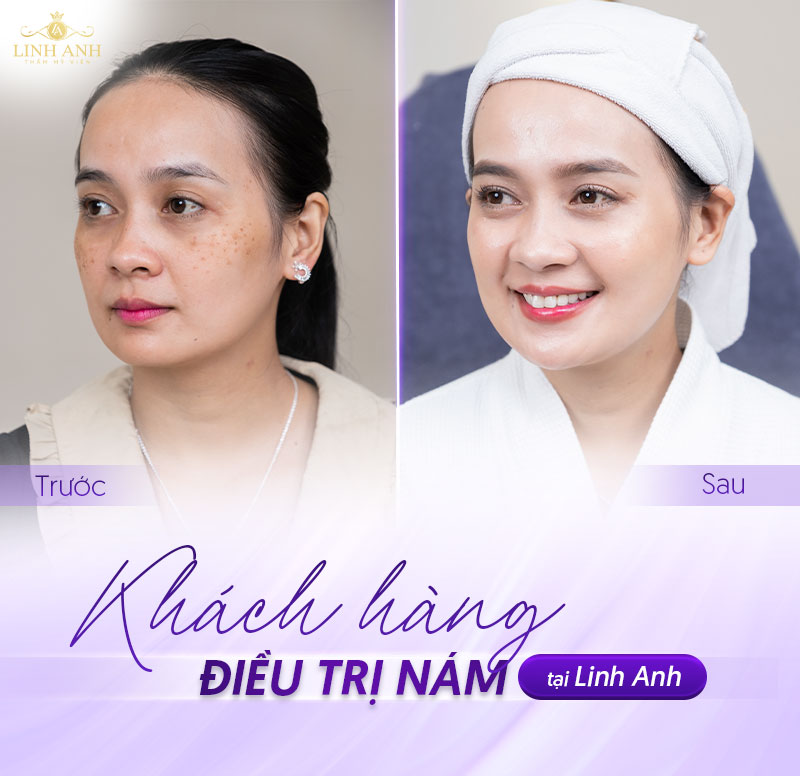 bảng giá trị nám bảng giá trị nám
