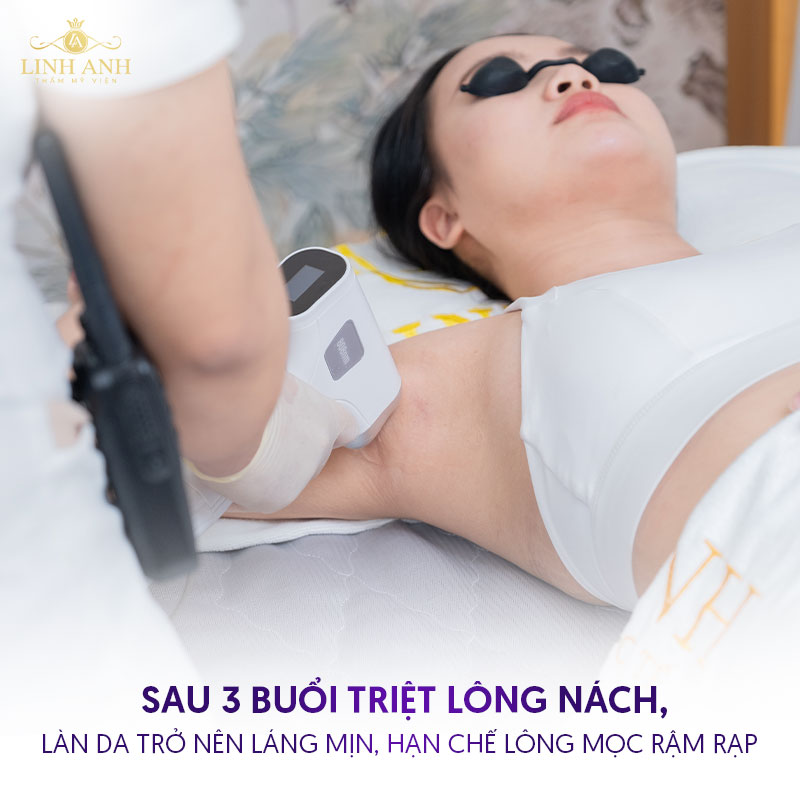 bảng giá triệt lông tại TMV Linh Anh bảng giá triệt lông tại TMV Linh Anh