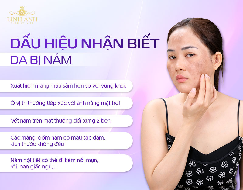 Dấu hiệu nhận biết da sạm nám