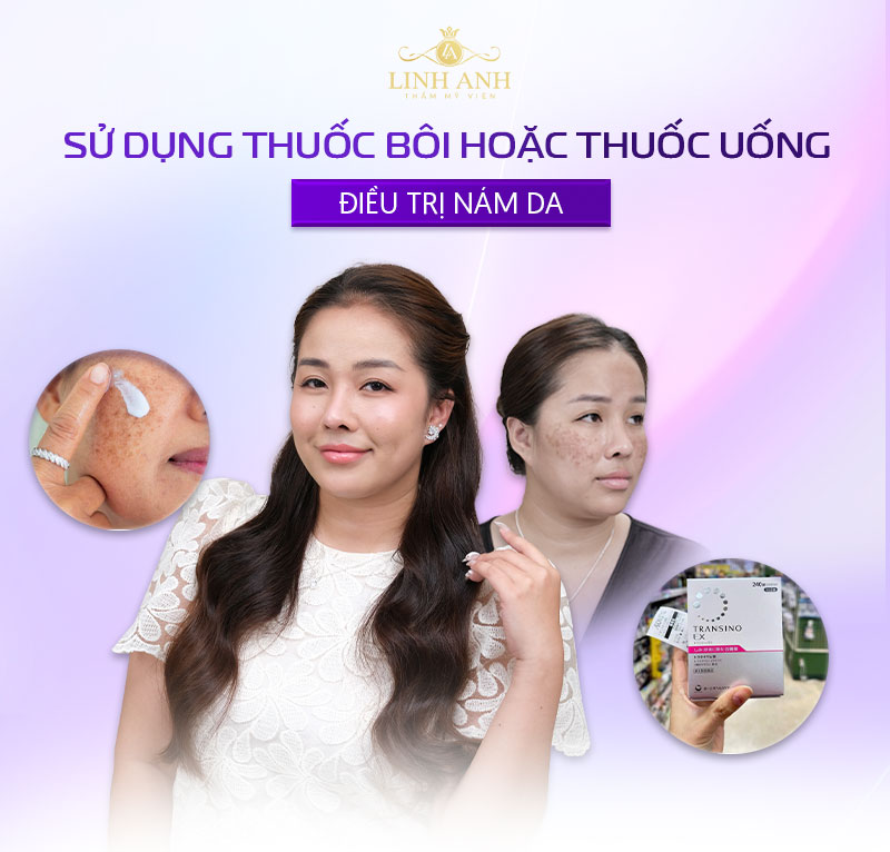 Dùng thuốc trị nám da
