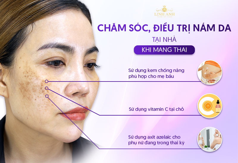 điều trị nám tại nhà