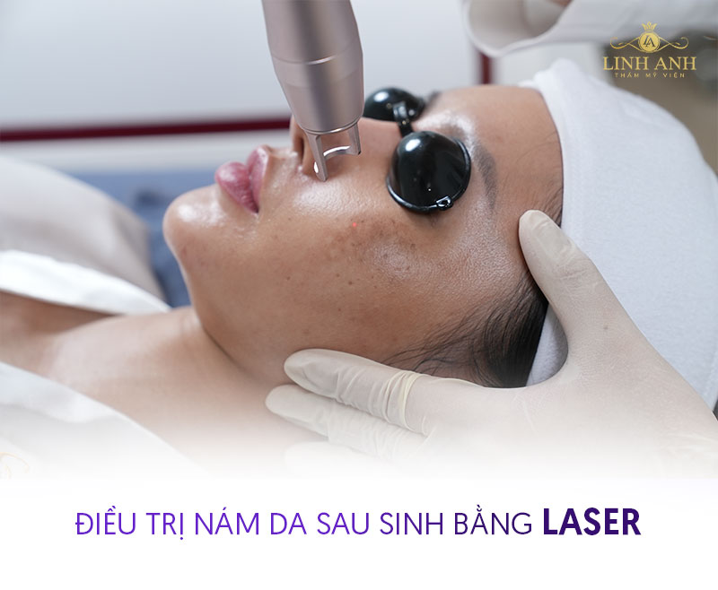 khách hàng điều trị nám sau sinh thành công