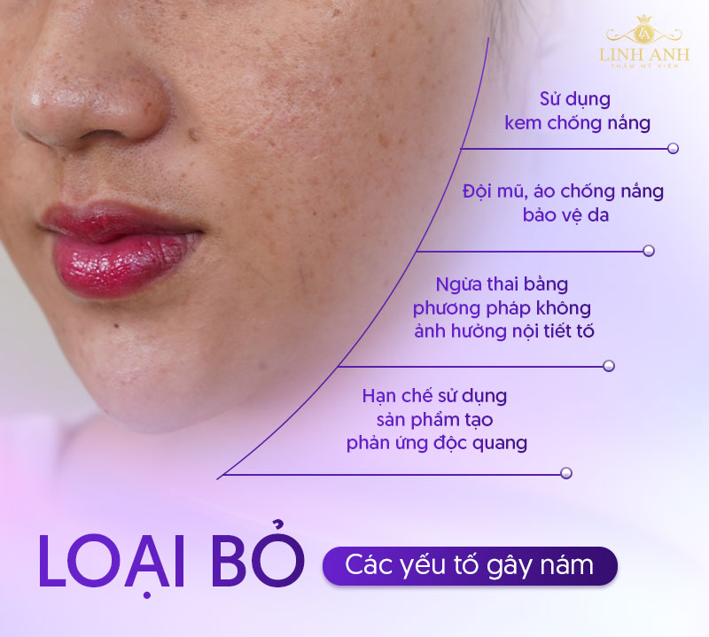 Cách loại bỏ nám quanh vùng môi ở miệng
